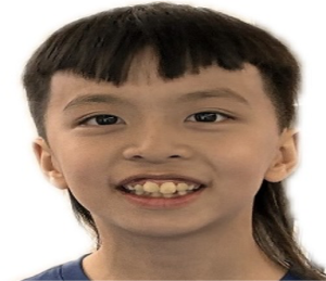 15 Xi-Che (Josh) Ma (U10A)