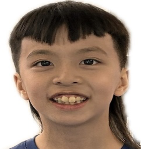 15 Xi-Che (Josh) Ma (U12B)